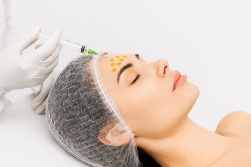 BioRePeel 35 TCA treatment