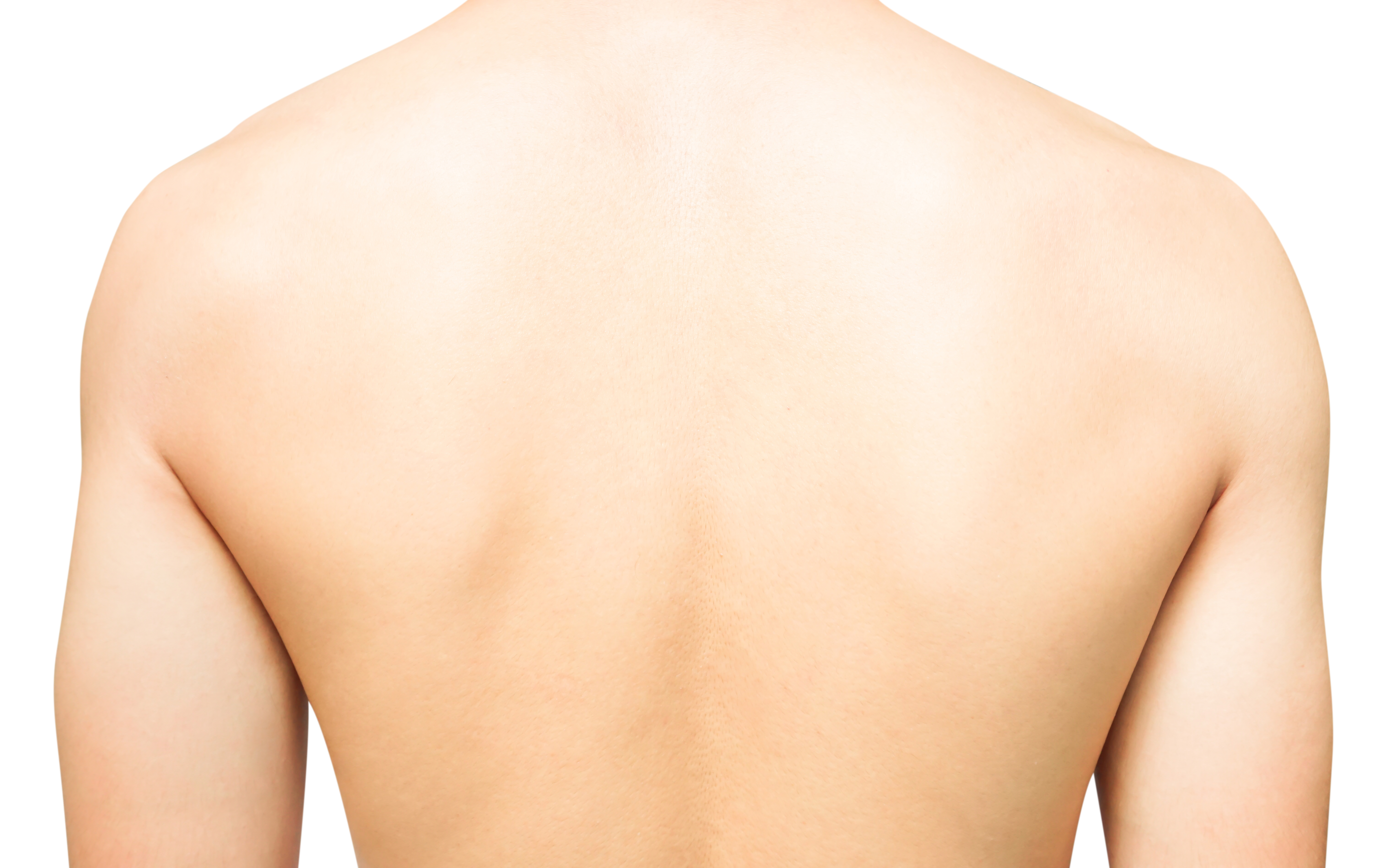 BioRePeel 50 TCA body treatment results